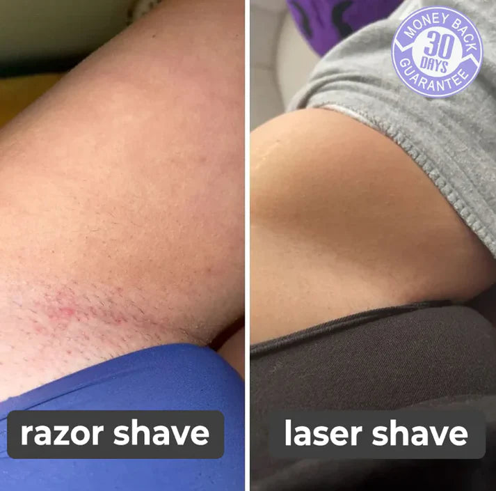 Painless Finishing Touch Hair Removal Epilator